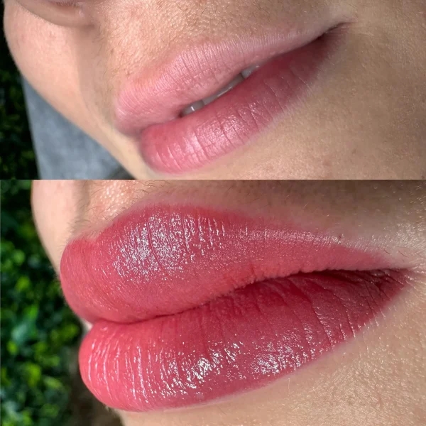 aquarelle lips before and after