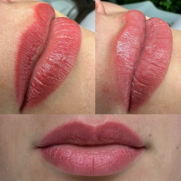 cosmetic tattoo removal clinic