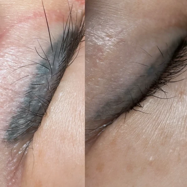 cost cosmetic tattoo melbourne
