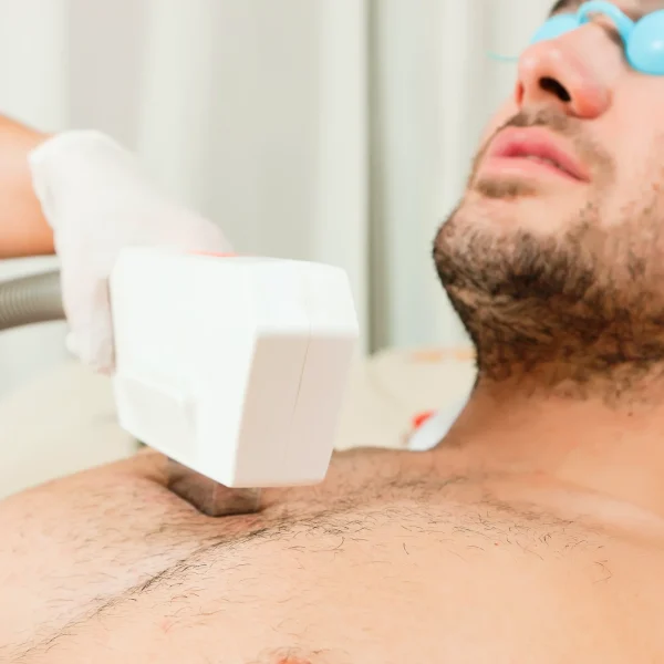 laser hair clinic melbourne
