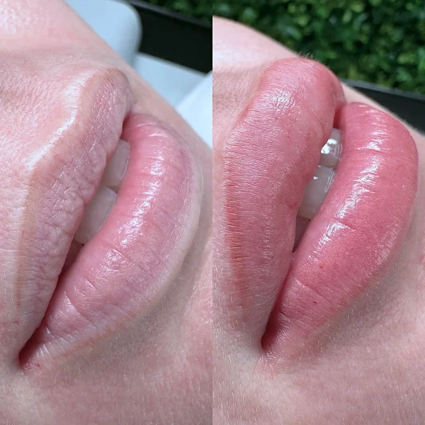 ombre lip blush before and after