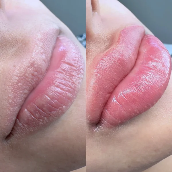 permanent ombre lips