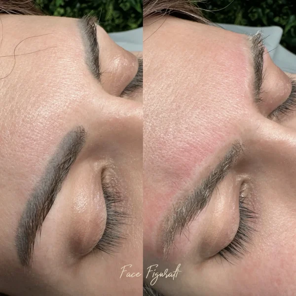 remove permanent makeup